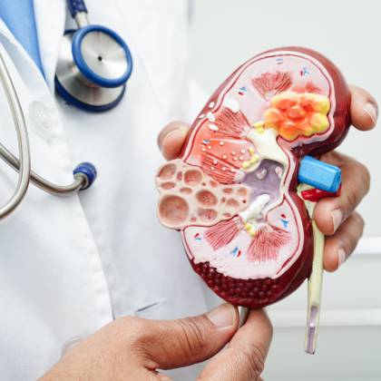 cita con nefrologos en ciudad satelite