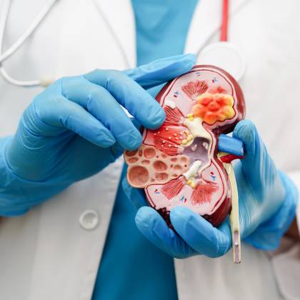 doctor nefrologo en cdmx