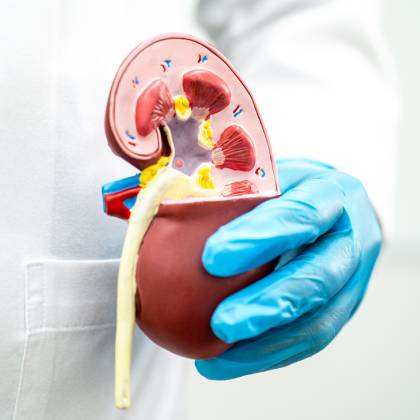 nefrologo de confianza en naucalpan