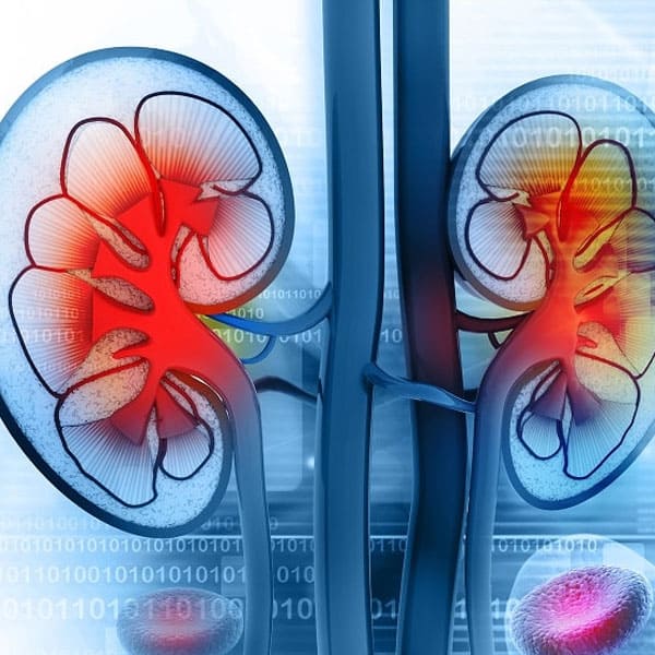 glomerulopatias